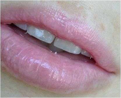 Блеск-бальзам для губ Lumene Raspberry Miracle Lip Perfecting Balm